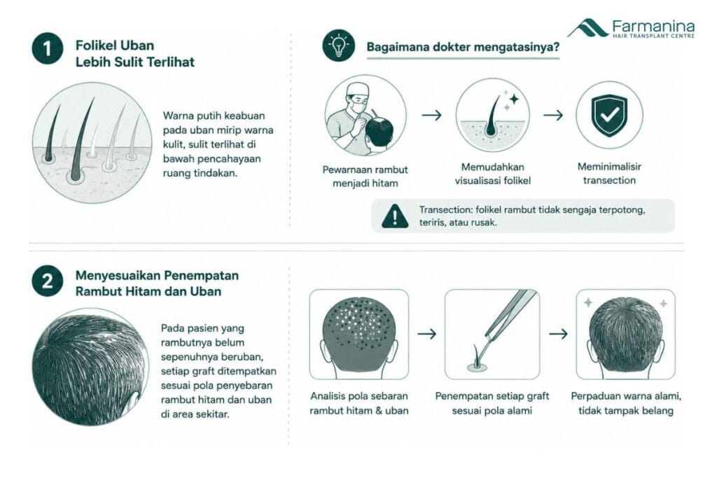 Tantangan menanam rambut untuk rambut beruban