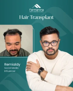 Farmanina-Before after (2)