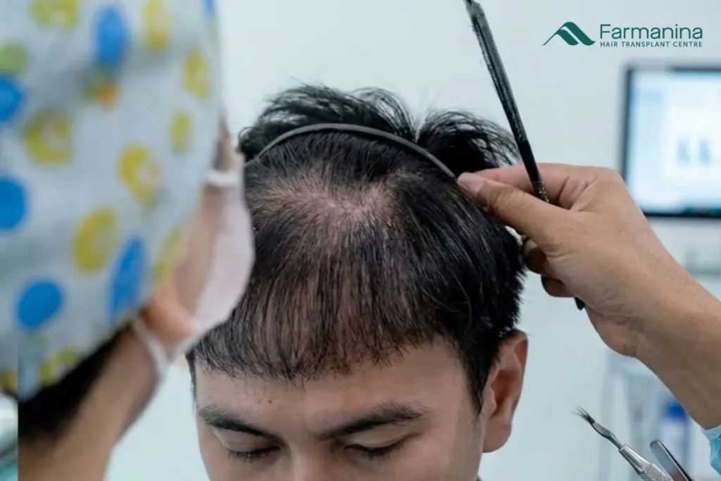 Rambut rontok dan botak