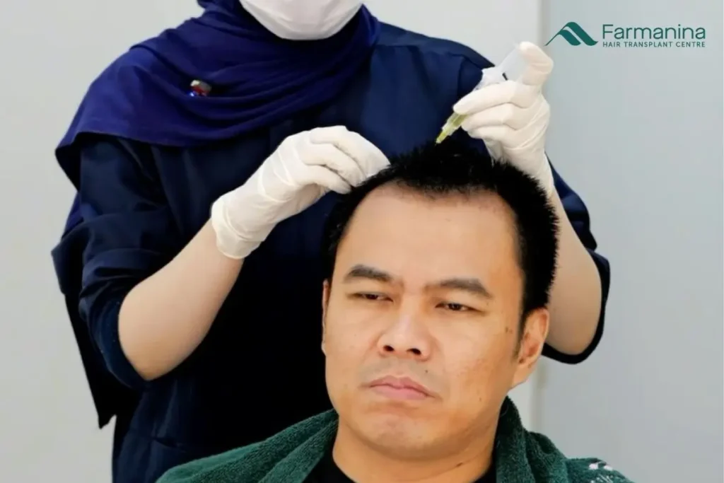 Treatment PRP di Farmanina Clinic