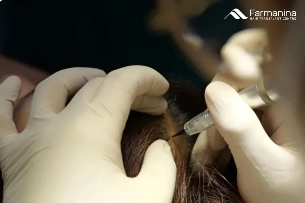 Scalp micropigmentation di Farmanina Clinic