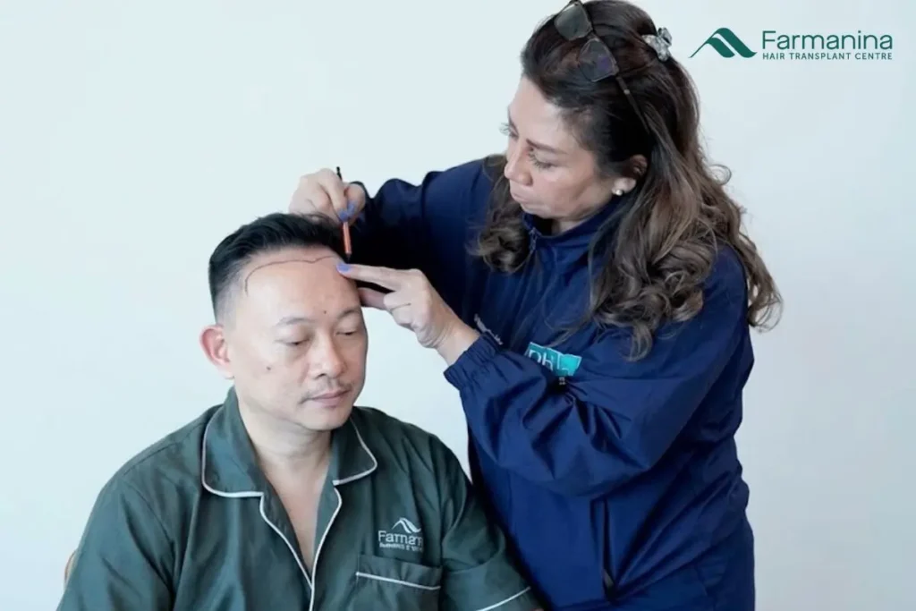 Tanam rambut Verdi Solaiman di Farmanina Clinic.
