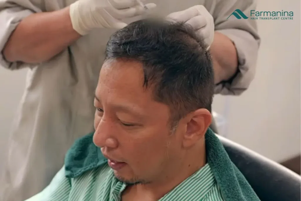 Perawatan rambut rontok di Farmanina Clinic.