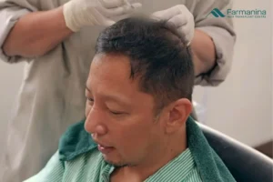 Perawatan rambut rontok di Farmanina Clinic.