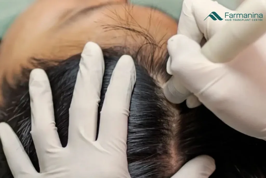 Scalp Detox di Farmanina Clinic