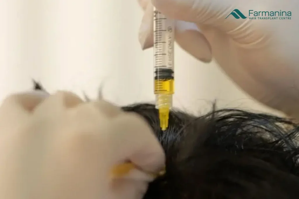 PRP rambut di Farmanina Clinic