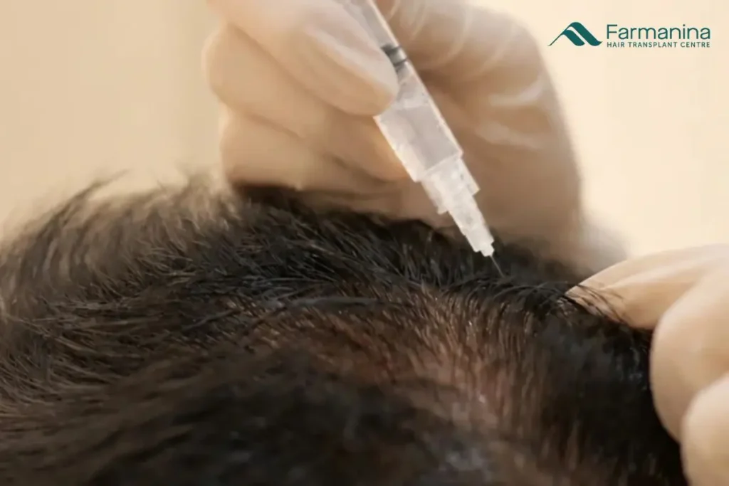 Hair exosome therapy di Farmanina Clinic.